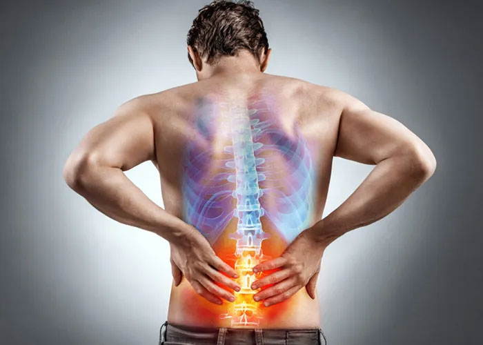 Come evitare l’infiammazione sciatica